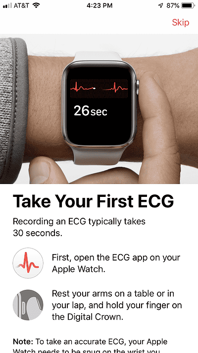 How To Set Up ECG On Apple Watch Series 4- The Mac Observer