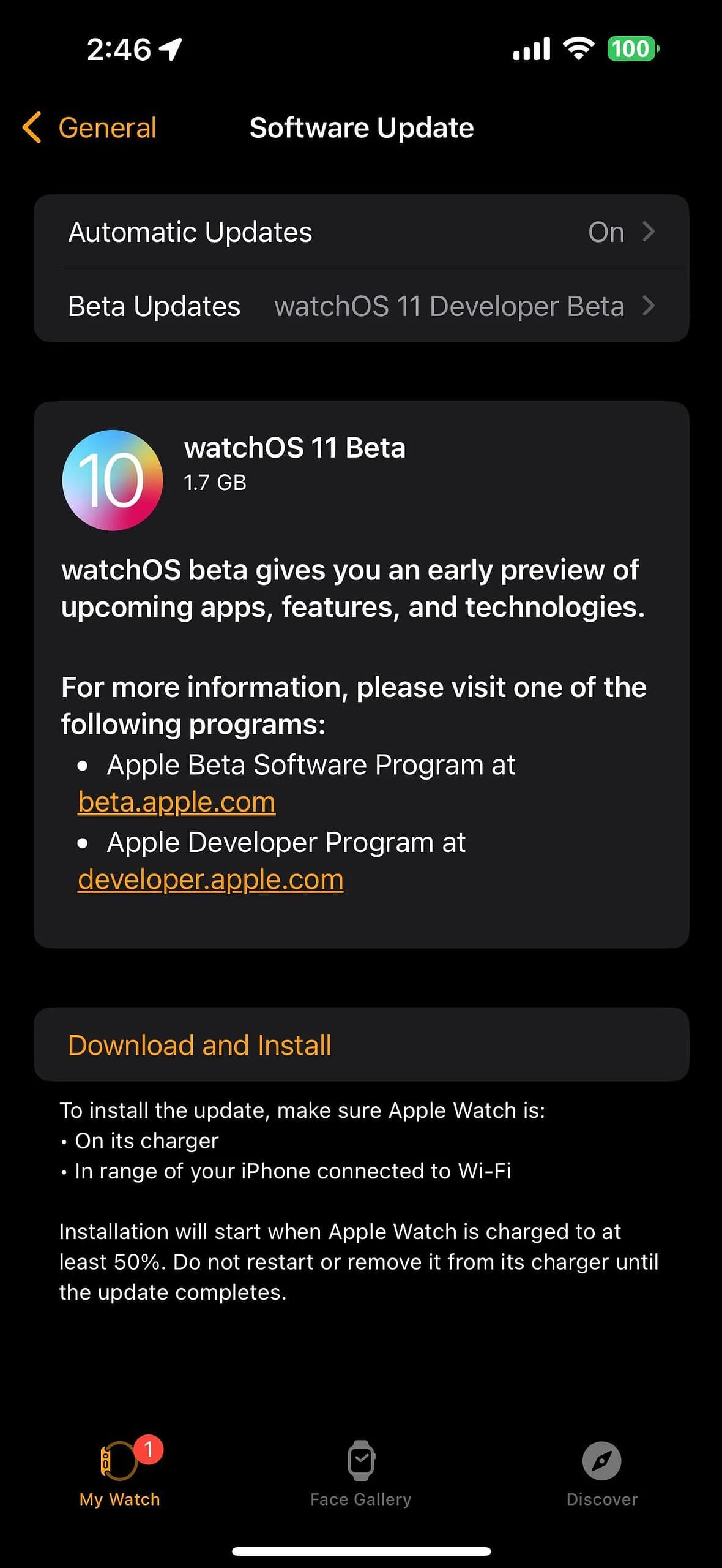 watchos 11 developer beta