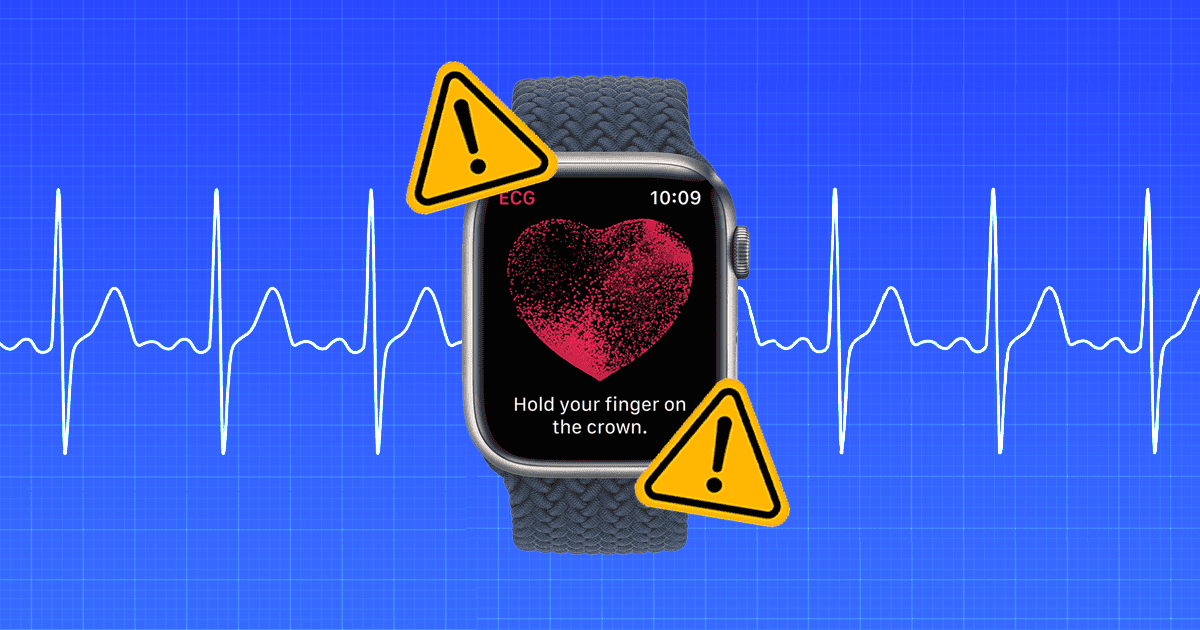 Apple Watch ECG Not Working? Here’s How To Fix It!