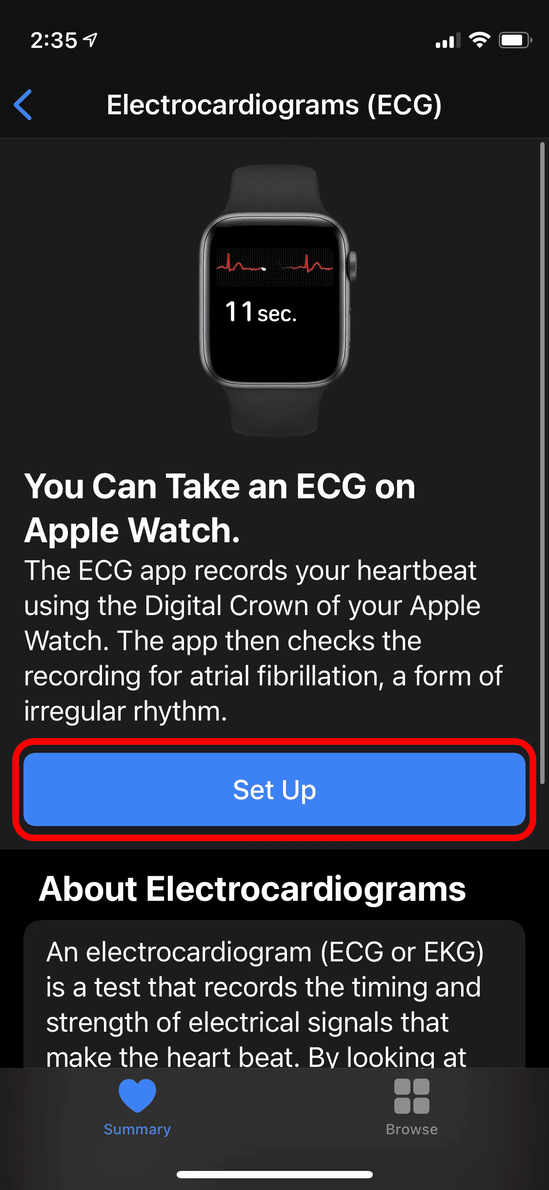 How to reset ecg on apple watch sale